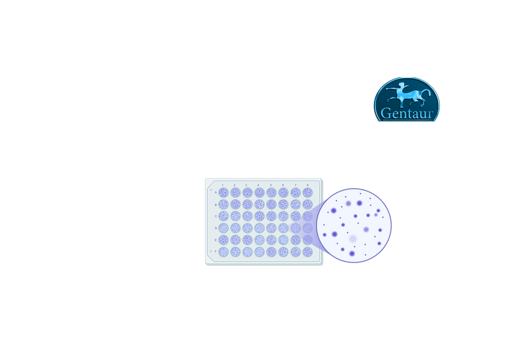 SARS-CoV-2 IGRA - INF-Gamma